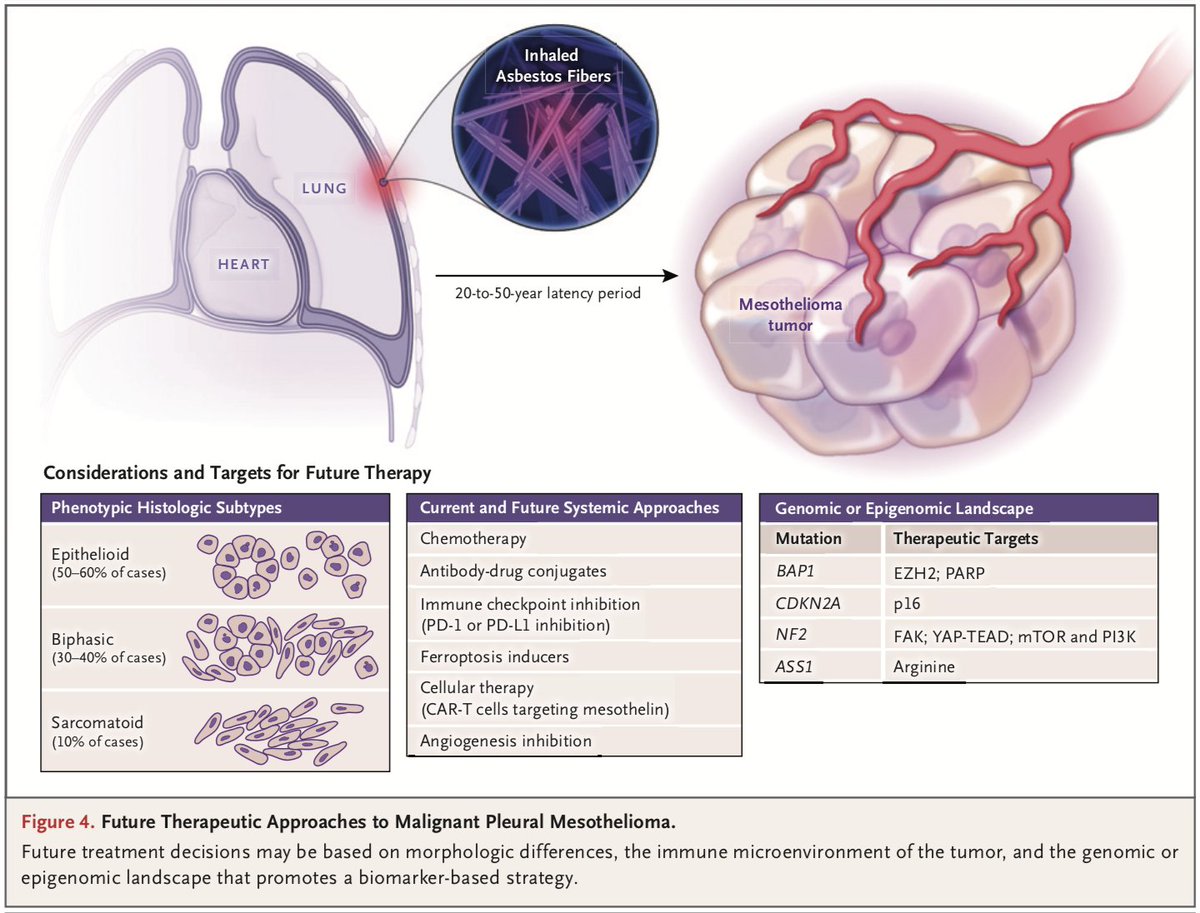 Really pleased to see our review on Mesothelioma out in NEJM this week @AlrifaiDoraid @dean_fennell. A great update for all on this disease so in need of further research and innovation. DOI: 10.1056/NEJMra1912719