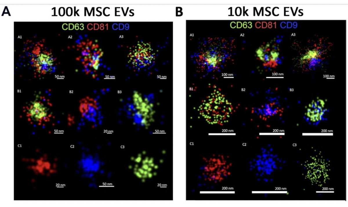 BBussolati's tweet photo. Curious about tetraspanin expression in small and medium/large mesenchymal stromal cell-derived extracellular vesicles in naive or apoptotic condition? have a look! https://t.co/tGty0IxBK2 #bioRxiv https://t.co/Hzf099VGYd