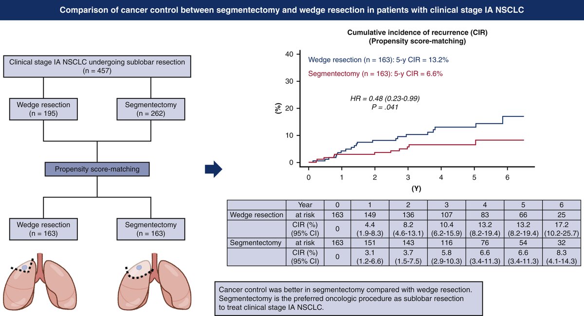 #GraphicalAbstract by Tsutani et al: Comparison of cancer control between segmentectomy and wedge resection in patients with clinical stage IA non–small cell lung cancer. Read the full article: ow.ly/ebX050Gc4Jb #JTCVS #cardiotwitter #cvsurg #TSSMN @AATSHQ