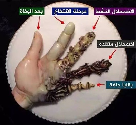 صورة توضح مراحل تحلل جسم الإنسان بعد الوفاة☠️🔎