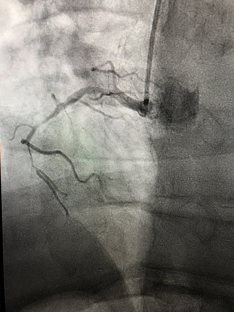 KeithNguyenSAIF's tweet photo. 💯 for this year 500 since 2016 CTO intervention rca @SAIFSanAntonio https://t.co/55VsU4Y68A