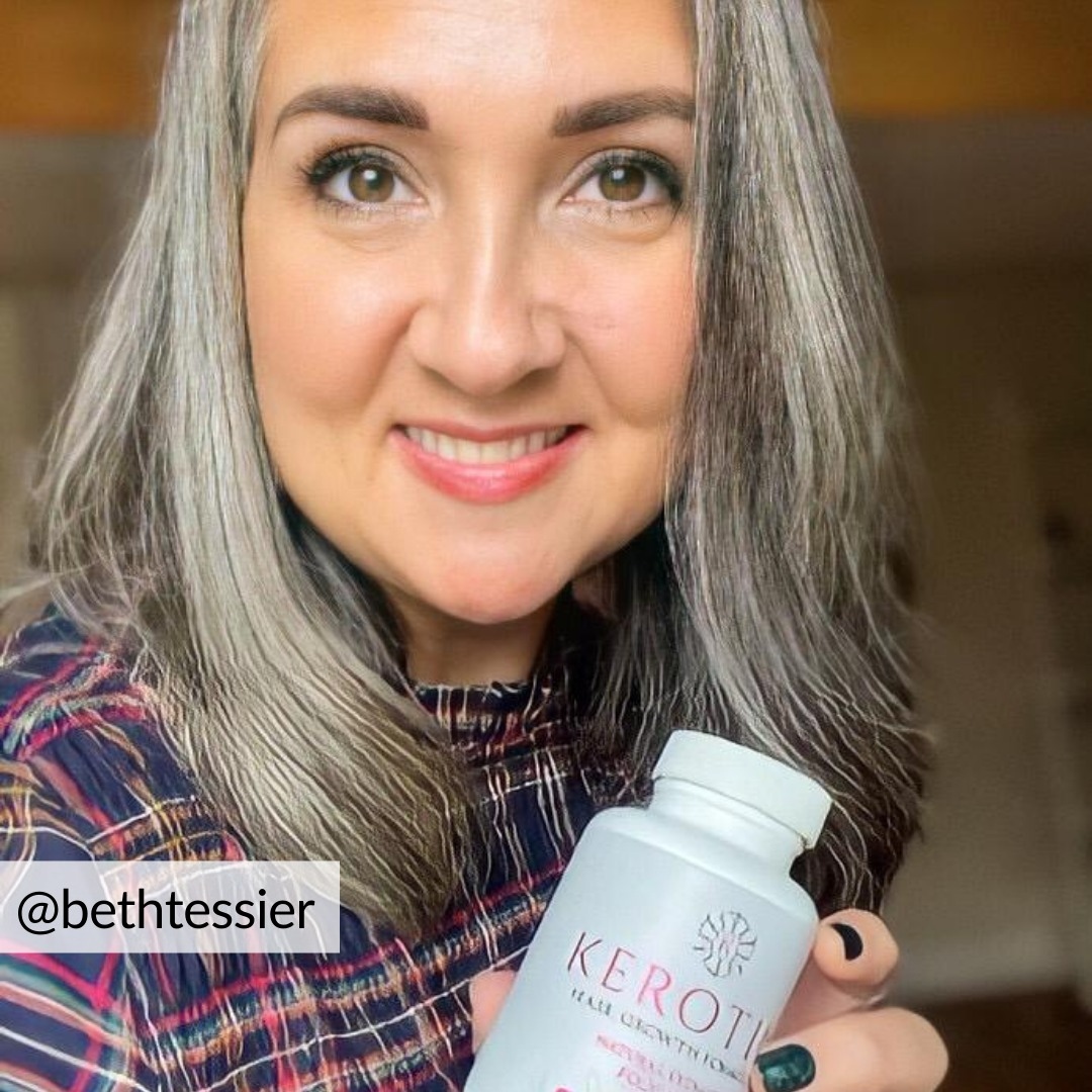 KerotinHairCare's tweet image. #thinhair #thinhairproblems #thinhairprobs #thinhairsolution #thinhairstyles #thinhairtothickhair #hairloss #hairlosssolution #hairlosstreatment #hairlosshelp #hairlosssolutions #hairlossspecialist #hairlossclinic #hairlosssollution #hairlossjourney
l8r.it/qiIp