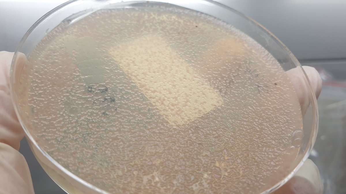 DrJordanBailey's tweet photo. We've had a busy week in the culture lab! Lockdown was the time to send in bulk lots of cultures. How odd are these Zymoseptoria? Nice pink though. Makes we want strawberry ice cream. #plantpathology #plantdisease #mycology #fungi https://t.co/lkfb3qC7i3