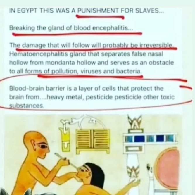 Nikkieportillo's tweet image. So that&apos;s where this is coming from 🤔🧐😱
#NasalSwab
#SwabTest