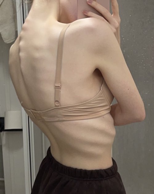 El Tw Bodycheck Does This Look Like Bmi 16 5 To U It Doesnt To Me Neg Ugh Bmi 15 I Want Uuuuu So Bad T Co Yalfhjjwyr Twitter El Tw Bodycheck Does This Look Like Bmi 16 5 To U It Doesnt To Me Neg Ugh Bmi 15 I Want Uuuuu So Bad T Co Yalfhjjwyr Twitter