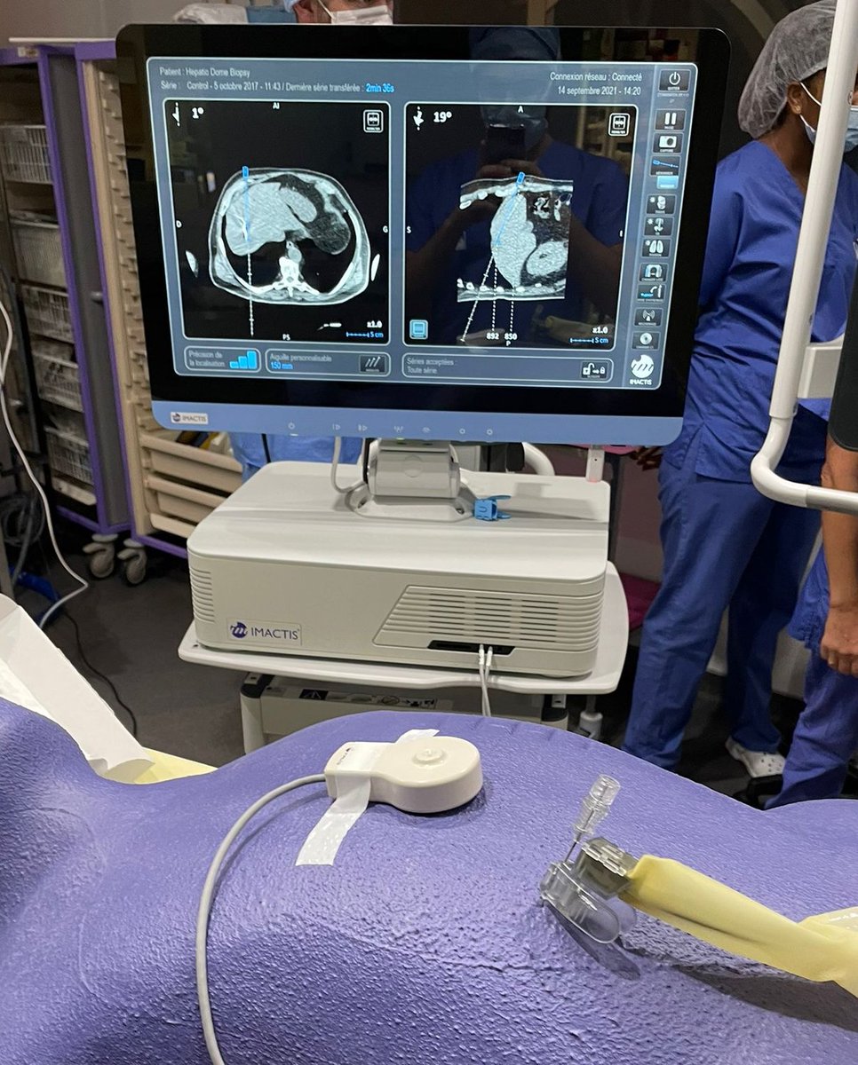 Vania TACHER (@vaniatacher) on Twitter photo Le service d’imagerie médicale s’équipe du système de navigation Imactis
The Henri Mondor Medical imaging department is now equipped with the Imactis navigation system
#noradiation
#noscalpel
#irads
<a href="/GuERI_France/">GuERI</a>
<a href="/CtNavigation/">IMACTIS CT-Navigation</a>
<a href="/GHUMondor/">GHU APHP. Hôpitaux Universitaires Henri-Mondor</a> Le service d’imagerie médicale s’équipe du système de navigation Imactis
The Henri Mondor Medical imaging department is now equipped with the Imactis navigation system
#noradiation
#noscalpel
#irads
<a href="/GuERI_France/">GuERI</a>
<a href="/CtNavigation/">IMACTIS CT-Navigation</a>
<a href="/GHUMondor/">GHU APHP. Hôpitaux Universitaires Henri-Mondor</a>