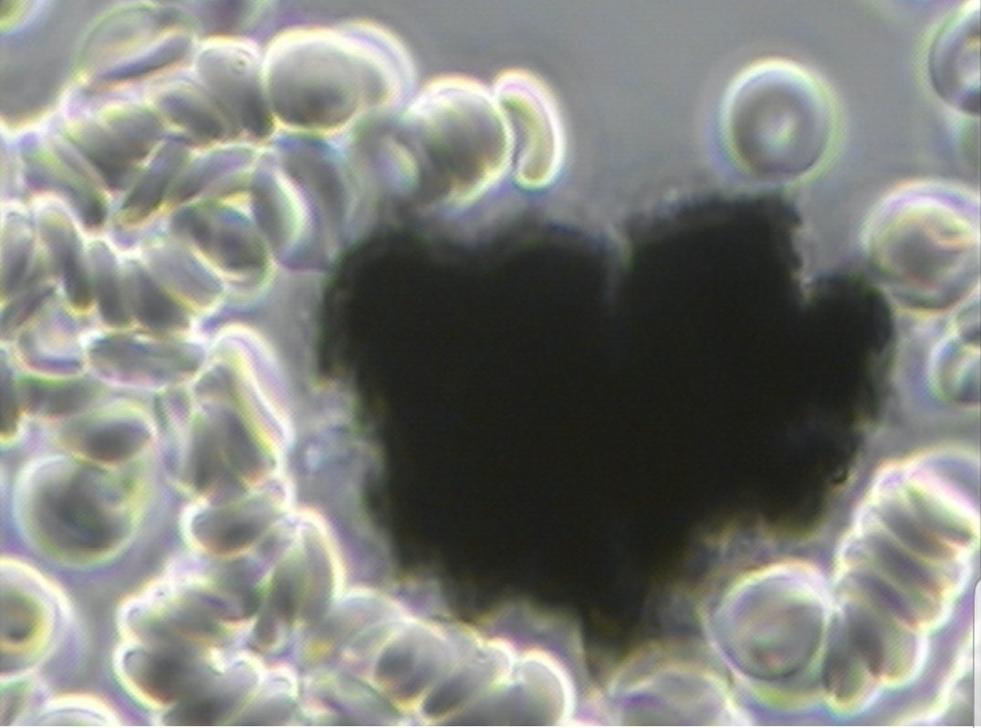 desi_athena's tweet photo. Pfizer "mRNA Aşısı" İçeriğinde Açıklanmayan Malzemeler:

Şekil 1: Grafen Oksid ( rGO )
Şekil 2: Trypanosoma Cruzi Paraziti
Şekil 3: Nano ve Mikro Partiküller https://t.co/GOZr0HUdoQ