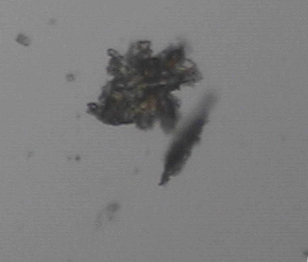 desi_athena's tweet photo. Pfizer "mRNA Aşısı" İçeriğinde Açıklanmayan Malzemeler:

Şekil 1: Grafen Oksid ( rGO )
Şekil 2: Trypanosoma Cruzi Paraziti
Şekil 3: Nano ve Mikro Partiküller https://t.co/GOZr0HUdoQ