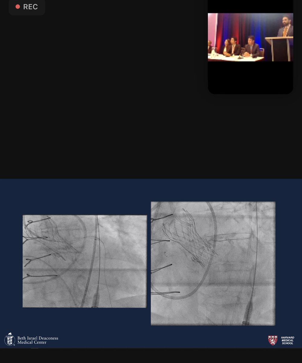 *Masks for All* SADIQ (@immadsadiq) on Twitter photo Great meeting in Boston. Congratulations and many thanks to <a href="/aicardio/">Ashequl Islam</a> 🙌✌️👍#NEVASH #tavr Great meeting in Boston. Congratulations and many thanks to <a href="/aicardio/">Ashequl Islam</a> 🙌✌️👍#NEVASH #tavr