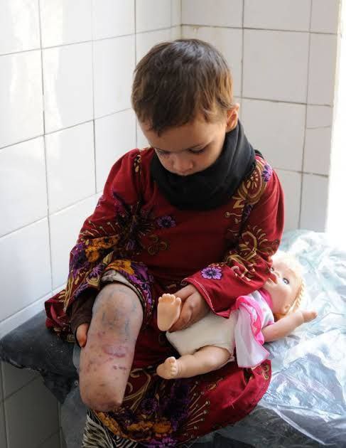 NO MATTER HOW SMALL YOUR INVESTMENT IS, IT WILL GO A LONG WAY IN PUTTING SMILES ON THE FACES OF THIS CHILDREN AND YOUR FACE TOO.

BUY HOLD AND SHILL GUA THAT'S ALL YOU JUST NEED TO DO!

❤️❤️❤️❤️❤️❤️❤️❤️❤️❤️❤️