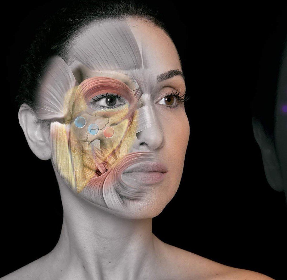 SkinOnlineBlog's tweet photo. Injectables have evolved rapidly &amp; so to have the random inexperienced injectors. Techniques are constantly changing, so the foundations of facial anatomy needs to be understood https://t.co/Yk6nLc6Aue

#SkinOnline #SkinOnlineBlog #skin #beauty #injectables #fillers #MDCodes https://t.co/URSUfKsTED