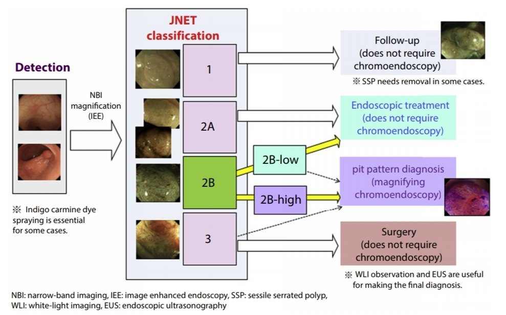 Классификации эндоскопия. JNET классификация. Классификация по Kudo. JNET классификация эндоскопическая. Kudo эндоскопия классификация.