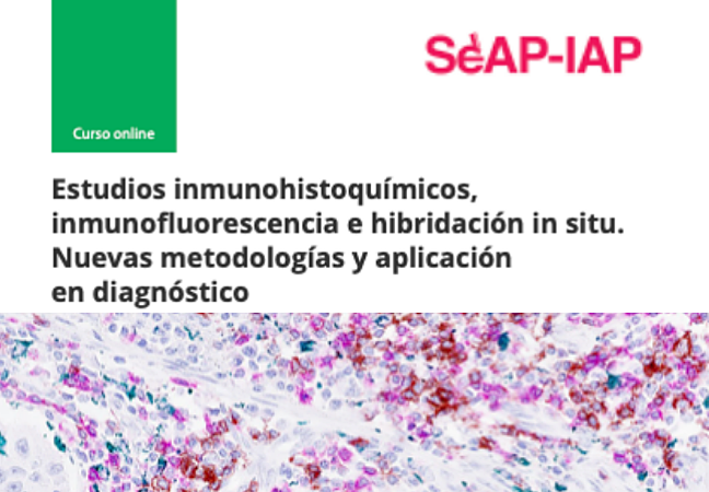 SEAP_IAP's tweet photo. Conoce los factores que pueden ocasionar errores en las técnicas de inmunofluoresencia e hibridación y cómo corregirlos, en el curso #EstudiosInmunohistoquímicos_inmunofluorescencia_e_Hibridación_in_situ de la @SEAP_IAP para el #TEAP
https://t.co/To367evAoc https://t.co/jtp8ssgqT8