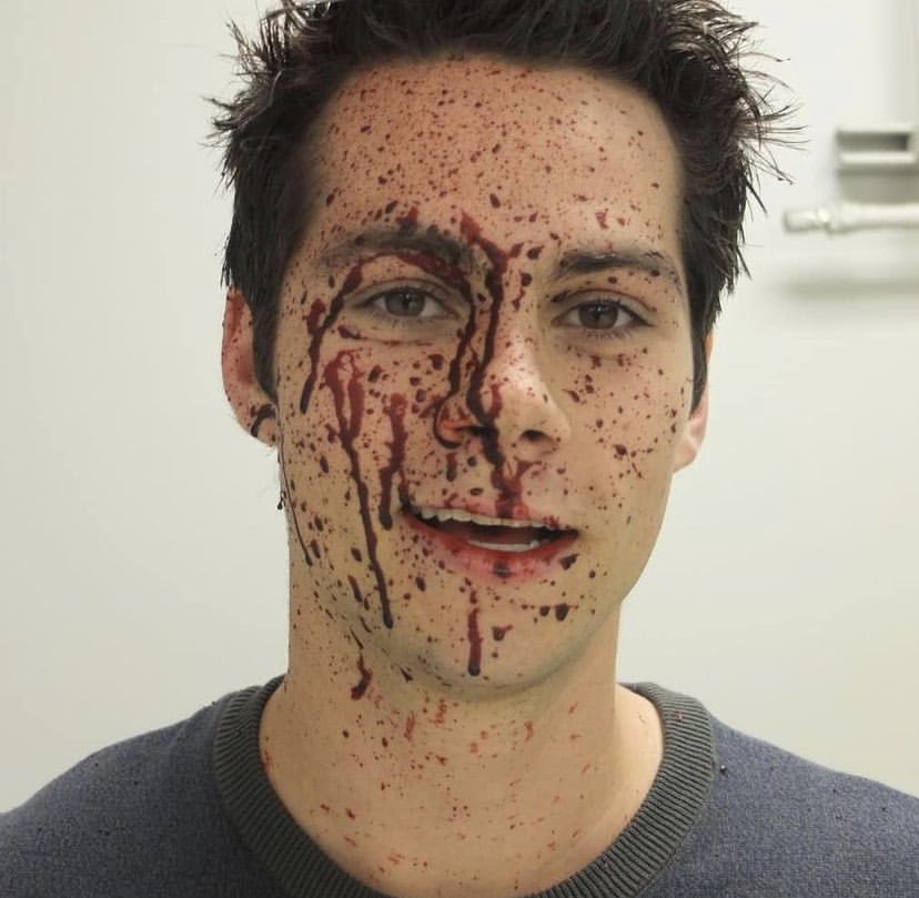 DylanOBrienPOL's tweet image. NOWOŚĆ: Nowe/stare zdjęcie za czasów kręcenia serialu Teen Wolf