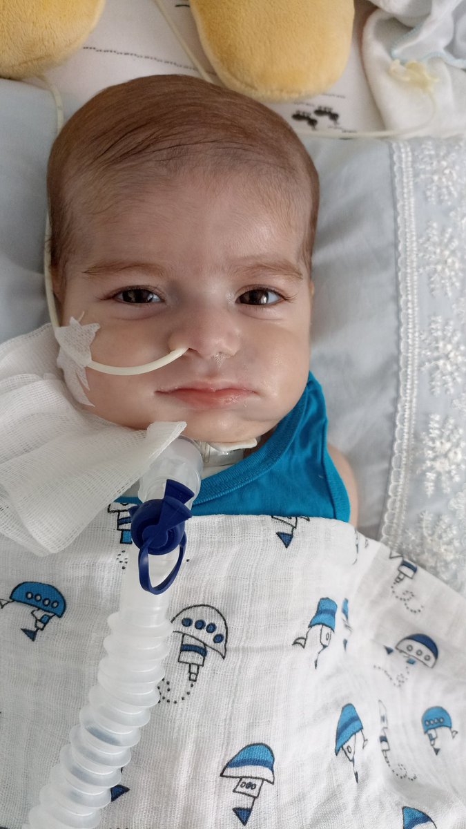 #SMAyıKarşılaSGK HAZAR 5 AYLIK VE CİHAZLARA BAĞLI YAŞİYOR TEK ÇARE #ZOLGENSMA ÇARENİN İÇİNDE ÇARESİZLİK YAŞAMAK İSTEMİYORUZ EVLATLARIMIZ'I BİR İLAÇ  YÜZÜNDEN KAYBETMEK İSTEMİYOZURUZ #fahrettinkoca #ZOLGENSMA #TÜRKİYEYE GELSİN İSTİYORUZ.
COCUKLAR UYURKEN SESİZ OLUNUR ÖLÜRKEN DEĞİL