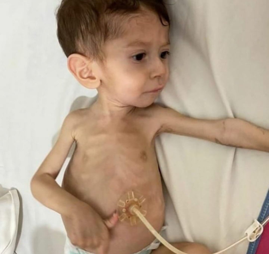 Parasızlık yüzünden çocuklarımız ölmesin
<a href="/saglikbakanligi/">T.C. Sağlık Bakanlığı</a>
<a href="/drfahrettinkoca/">Dr. Fahrettin Koca</a>
#SMAyıKarşılaSGK