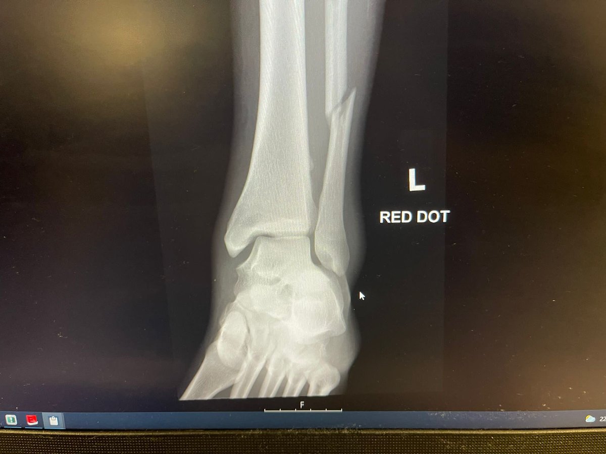 New Cross Rovers First Team tweet media