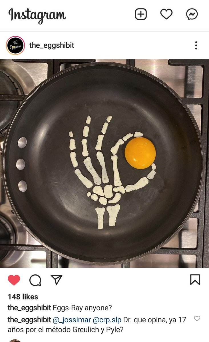 fsodagari's tweet photo. Eggs-ray anyone?
By talented https://t.co/npRVYRdP3E
#radiology #radarts #eggs #eggarts #Radfun #Radhumor #MedEdArts https://t.co/X0yYtSy0ZV