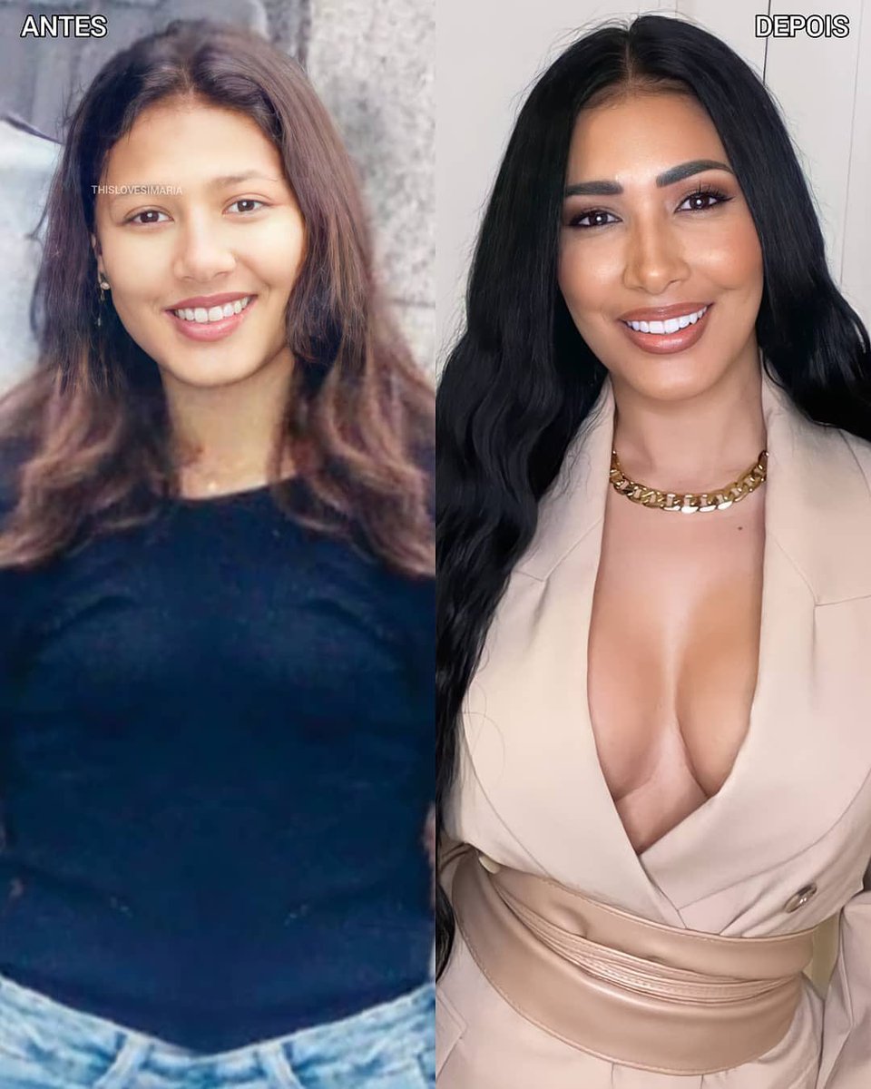 Esse antes e depois hein 😨