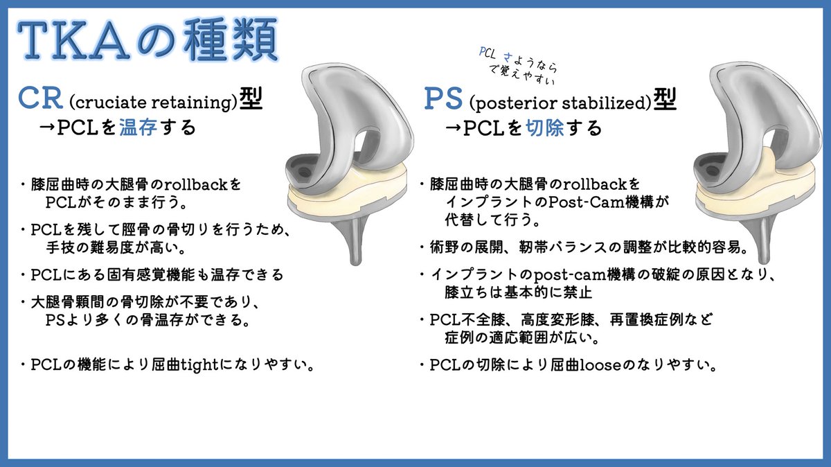 yujikawa32's tweet photo. 【再投稿】

変形性膝関節症まとめです。
TKAや外反母趾の手術は、シンプルに曲がっているものが真っ直ぐになる喜びがある。

(新作は10/4再開予定)

#変形性膝関節症
#TKA
#イラスト日記 https://t.co/WKCW3xlLsI