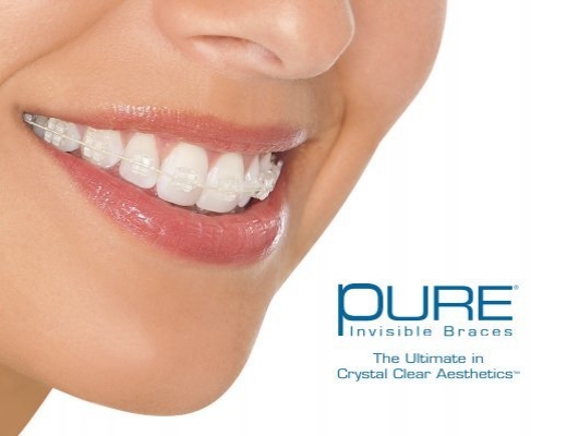 Most adult patients want their treatment to be as discreet as possible, which is why we offer PURE Invisible Braces here at Baptiste Orthodontics. Not only are they virtually invisible against any tooth shade, but they stay crystal clear without staining ow.ly/RKL450GgMTQ