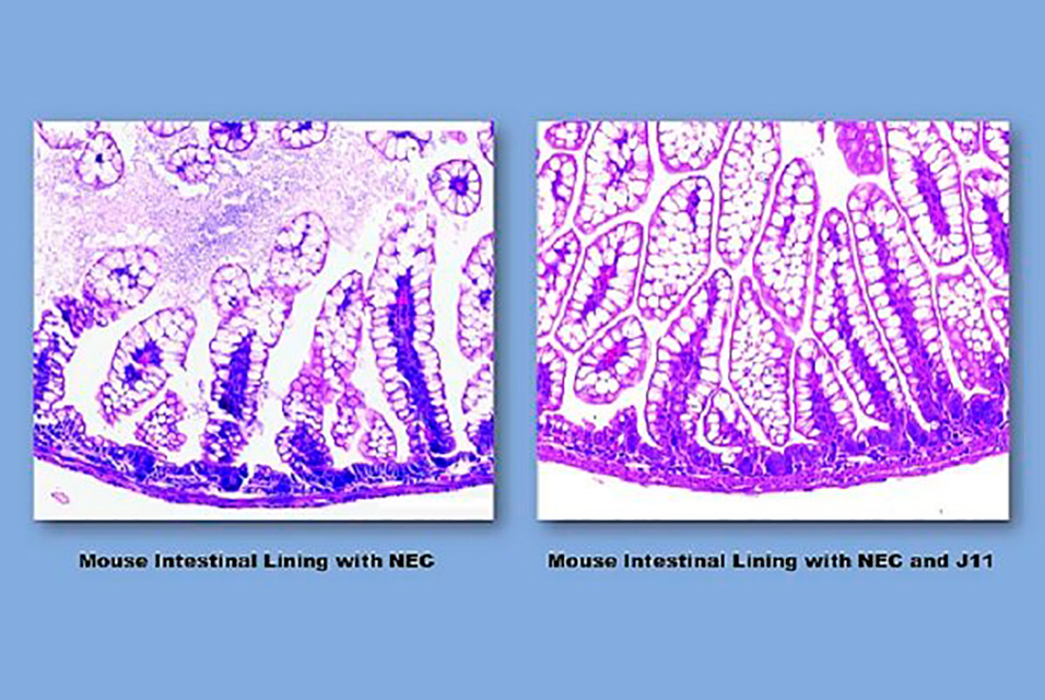 Researchnewscc's tweet image. Chain of events leading to dangerous intestinal disorder in preemies #chain #events #intestinaldisorder #preemies #research #newspaper

Read more about this here: ow.ly/Fc0c50GgBJw

Subscribe for free to ResearchNews Newsletter: researchnews.cc/index.asp?int_…