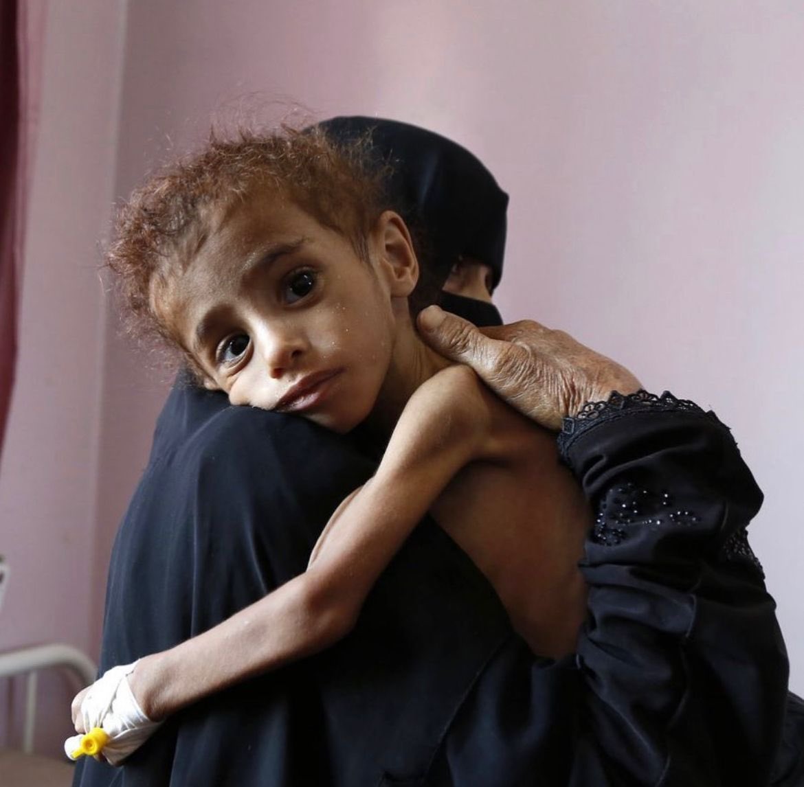 KhaledBeydoun's tweet photo. 14 million Yemenis — the majority of them children — face starvation this year. 🇾🇪 https://t.co/a12JhRHa4J