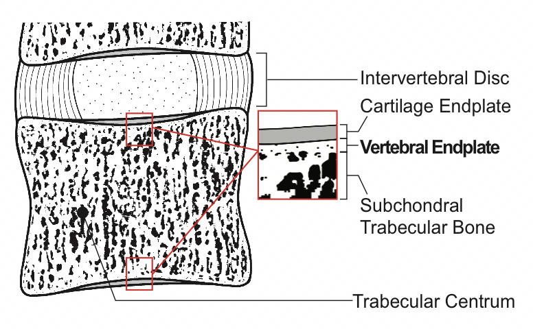 With help from <a href="/hunhun26625040/">Yuanqiao Wu</a>, <a href="/FredyLoaiza89/">Johnfredy Loaiza</a>, <a href="/rohin_banerji/">Rohin Banerji</a> and @LivBlouin, we aimed to measure the mechanical behavior of the human vertebral endplate, a thin, porous plate of bone tissue at the place where the intervertebral disc and connects to the vertebra. (2/9)
