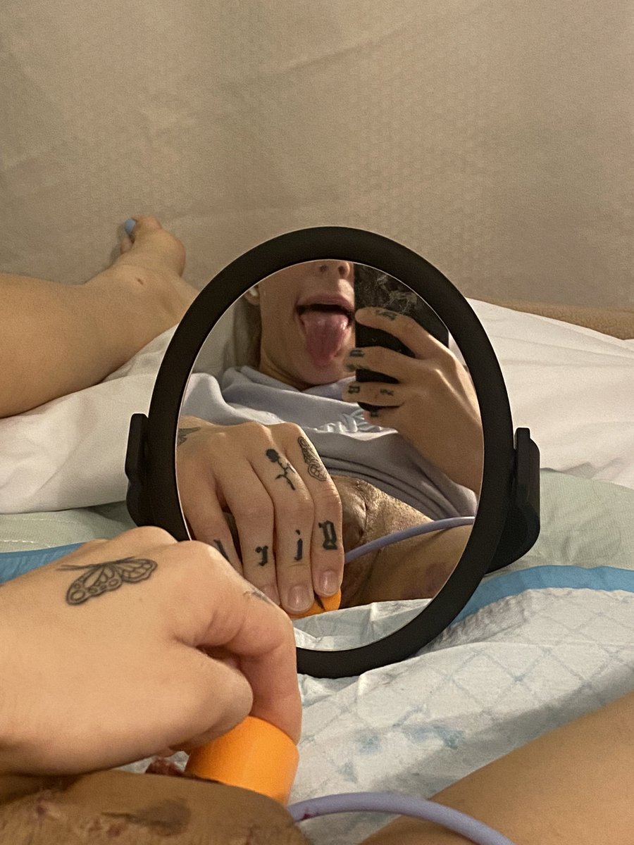 botomsurgery101's tweet photo. So dilating day 1 is a success. Uncomfortable yes. Terrible no. Proud I got the biggest one in that’s a good sign. Ultimately width can be gained or restored. Depth can’t, so always making sure it goes and hits the back wall of my vaginal cavity! https://t.co/sS2ukBDd2Y