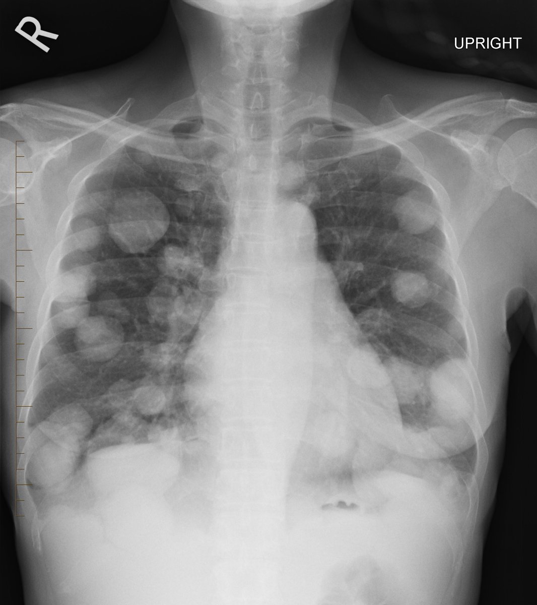 Singapore General Hospital (SGH) Imaging tweet media