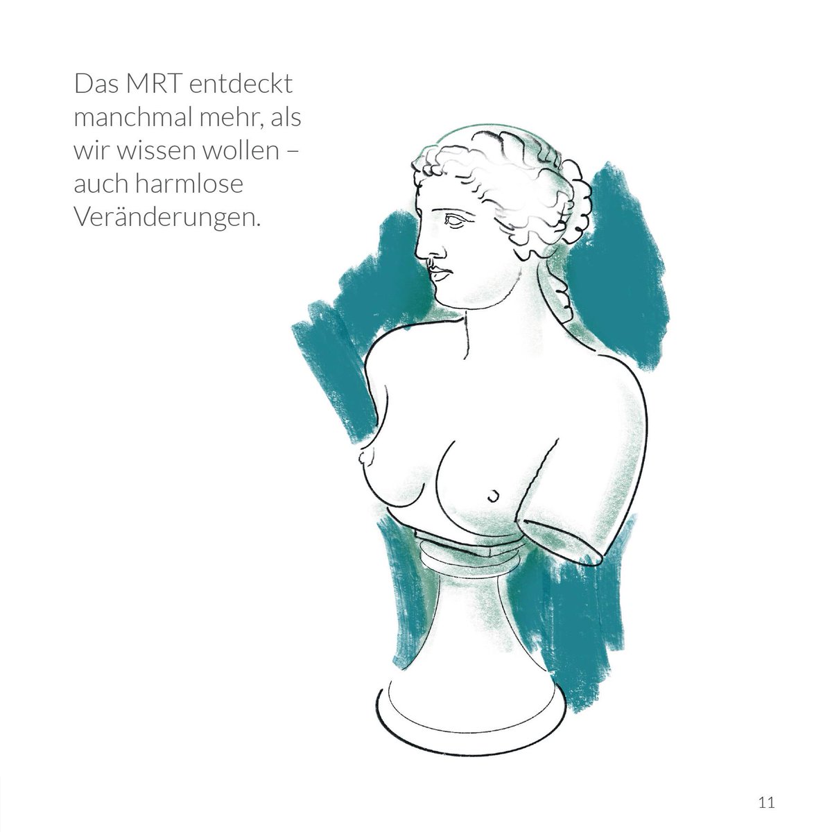 Ein #MRT bei #Brustkrebs im Frühstadium ist sinnvoll, wenn ein genetisch erhöhtes Risiko für Brustkrebs besteht oder mehrere Krebsherde vermutet werden. Andernfalls reichen #Mammographie oder #Ultraschall aus. Erfahren Sie mehr: gemeinsam-gut-entscheiden.at/kein-mrt-bei-f…