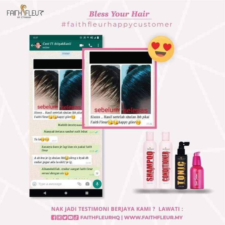sarabeay's tweet photo. FULLSET FAITH FLEUR🥰

Set ni memang cukup lengkap untuk selesaikan 1001 masalah rambut korang🥰 Especially untuk masalah rambut gugur lepas bersalin.

Seram uii nak belai rambut sendiri. Rambut gugur macam baru lepas buat kemoterapi luruhnya😣😖Berkepul kepul penuh dekat sikat😵 https://t.co/vgG0FjTzJj