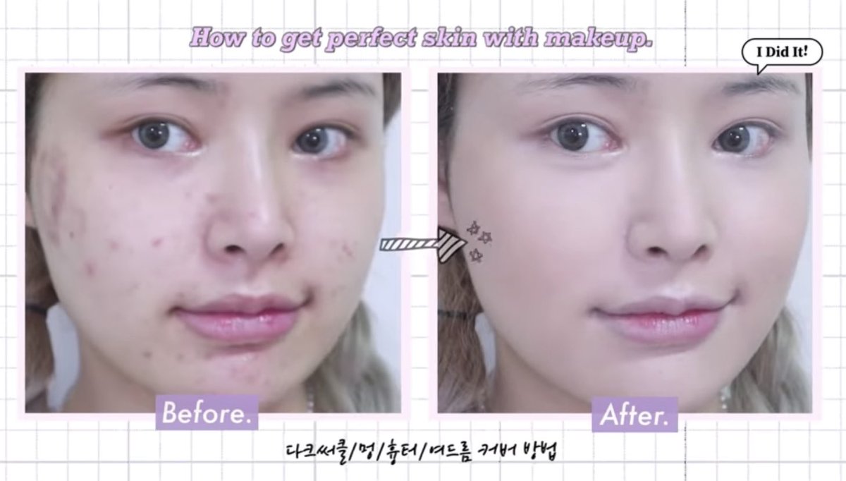 ter_tories's tweet image. ยทบ. jaymeeforyou สอนลงคอนซีลเลอร์ยังไงให้ปกปิดรอยแดงรอยดำ รอยแดงให้เนียนกริบบบบบ เขาใช้คอนซีลเลอร์ the saem ให้การปกปิดรอยสิว และแชร์ทริคเล็กๆว่าให้ใช้คอนซีลเลอร์ที่มี moisturizer เพิ่มเล็กน้อยจะเนียนกว่า #howtoperfect 

youtu.be/EcisNTzfgOQ