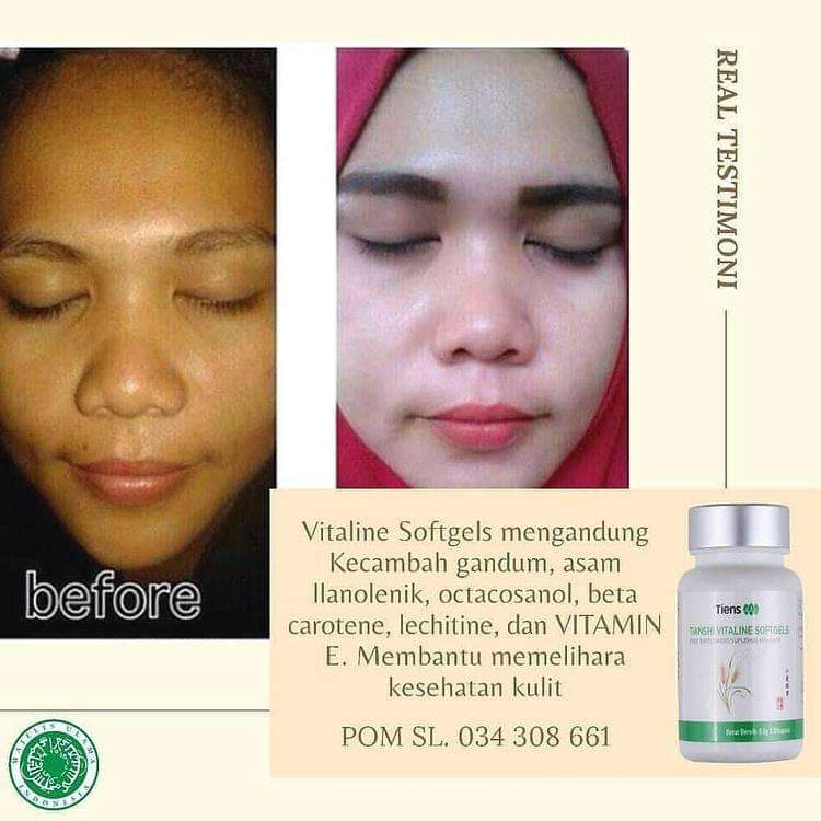 EndangGeulis15's tweet photo. Hallo ka ingin putih seluruh badan permanen yuk order vitalin Aman bpom🥰 #pemutihseluruhbadan  #bpom #tiens #wajahglowing https://t.co/mdaG4FeDi9