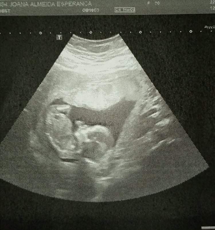 05Nome's tweet photo. 🍼❤ https://t.co/cqdIISUvgE