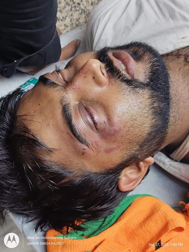 imSaffronAshu's tweet photo. Disturbing pictures of Sri Mukund Jha, President, @BJYM South Kolkata after he was brutally attacked by TMC goons at Bhawanipore today while campaigning with Sri @DilipGhoshBJP

#AbaroHarbeMamata is an irrefutable truth and Mamata Banerjee has once more ashamed the Democracy. https://t.co/N8Niayx2zJ