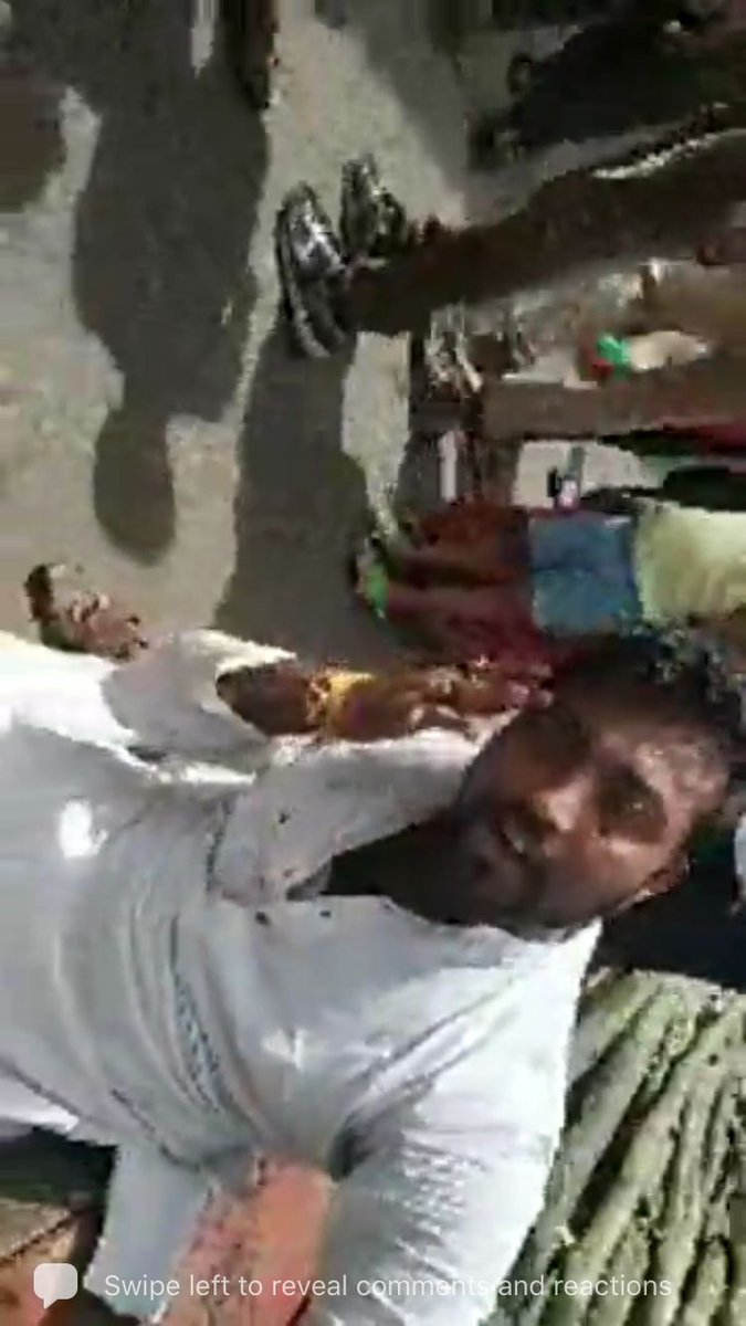 imSaffronAshu's tweet photo. Disturbing pictures of Sri Mukund Jha, President, @BJYM South Kolkata after he was brutally attacked by TMC goons at Bhawanipore today while campaigning with Sri @DilipGhoshBJP

#AbaroHarbeMamata is an irrefutable truth and Mamata Banerjee has once more ashamed the Democracy. https://t.co/N8Niayx2zJ