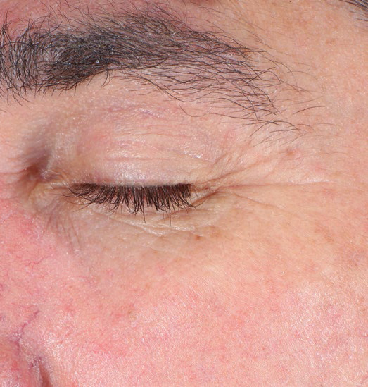 SUPPLIER NEWS: AestheticSource launch NEW skinbetter science® EyeMax AlphaRet® Overnight Cream. A rich, silky overnight eye cream designed to deeply hydrate, revitalise and smooth the appearance of the skin around the eye area.

<a href="/AestheticSource/">AestheticSource</a> <a href="/jennypabila/">Jenny Pabila NichePR</a>