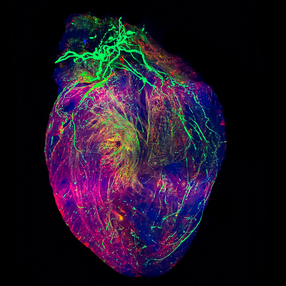 Helmholtz Munich | @HelmholtzMunich (@helmholtzmunich) on Twitter photo 👏 New grant for Ali Ertürk (<a href="/erturklab/">Ali Max Erturk</a>) 👏
Ertürk will collaborate with NOMIS to deliver a Human Heart Atlas: the project aims to generate vascular, cellular, and molecular maps of the human #heart by using novel technologies in #imaging and #AI.
‣ bit.ly/3zFQoPH 👏 New grant for Ali Ertürk (<a href="/erturklab/">Ali Max Erturk</a>) 👏
Ertürk will collaborate with NOMIS to deliver a Human Heart Atlas: the project aims to generate vascular, cellular, and molecular maps of the human #heart by using novel technologies in #imaging and #AI.
‣ bit.ly/3zFQoPH