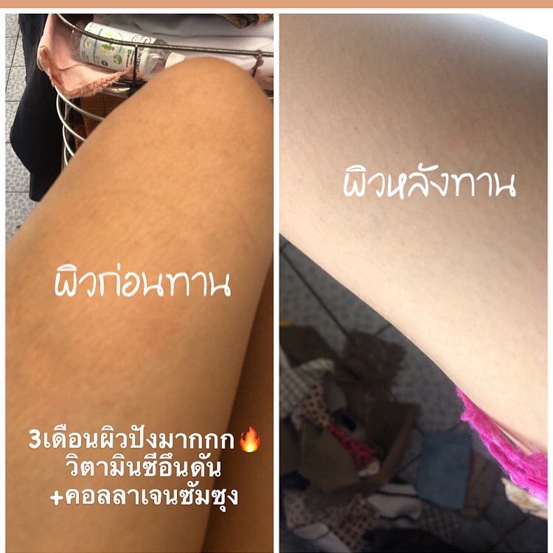 ftz_s's tweet photo. 5 ห่อ 1,000฿
💜https://t.co/I9tvyZZjQ4💜
#พรีออเดอร์เกาหลี #preorderkorea #ผิวใส #ผิวขาว #koreaeundanvitaminc1000 #vitaminckorea #koreaeundan #koreaeundanvitaminc #โคเรียอึนดันวิตามินซี #วิตามินอึนดัน #วิตามินเกาหลี #สกินแคร์เกาหลี #ชี้เป้าโปรถูก https://t.co/Q5kD9IxFOJ