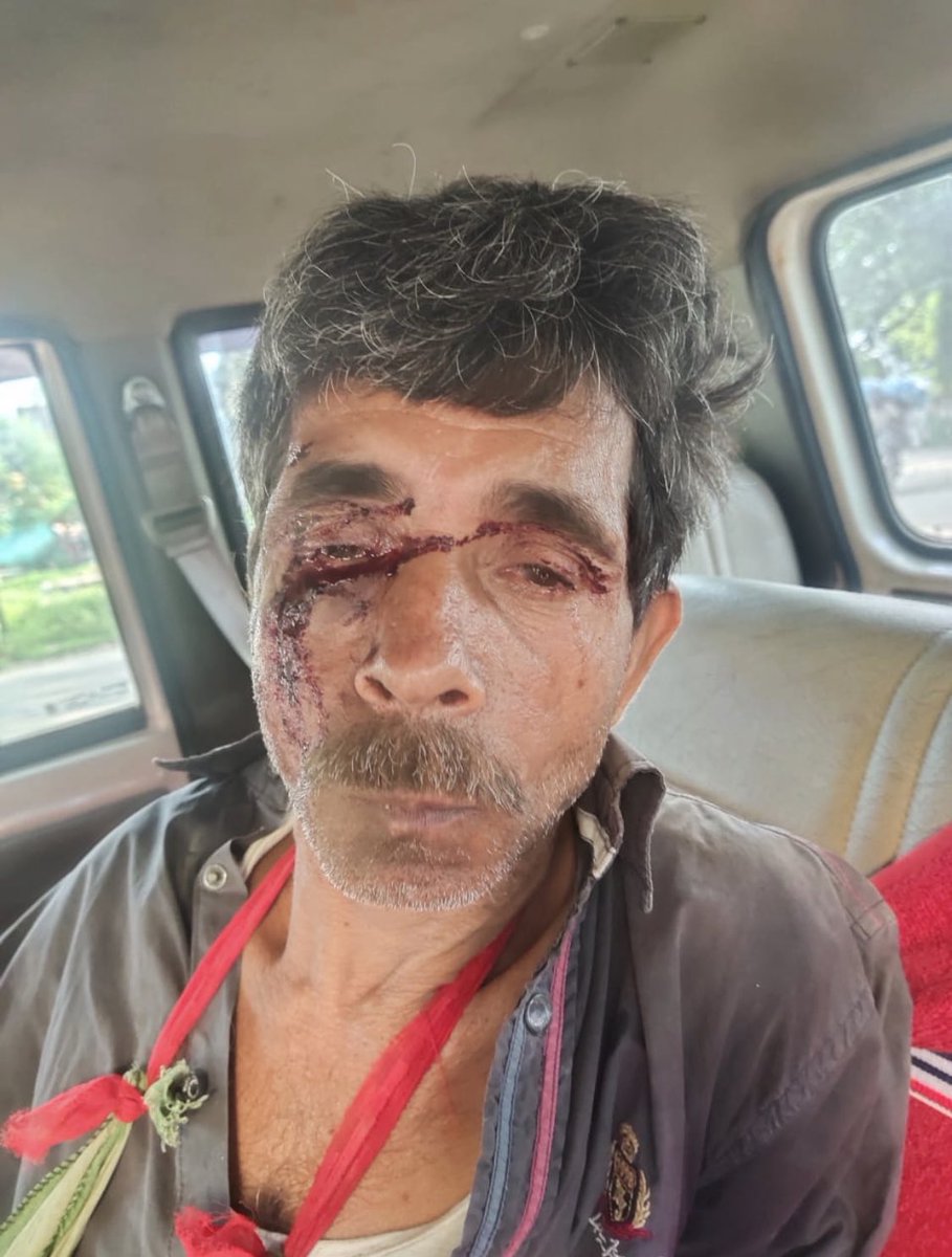 alnassar_kw's tweet photo. رابطة العالم الإسلامي فاهمين الاعتدال غلط، يستنكرون الجرائم ضد غير المسلمين ولو كان المظلوم فردا، ويصمتون عن ظلم المسلمين ولو كانوا بالملايين، خشية أن يُتّهموا بالانحياز للمسلمين!

استنكروا قتل الرسام الذي استهزأ بالنبي ﷺ ويصمتون عن اضطهاد٢٥٠مليون مسلم هندي!
#الهند_تقتل_المسلمين https://t.co/I04McHfyBp