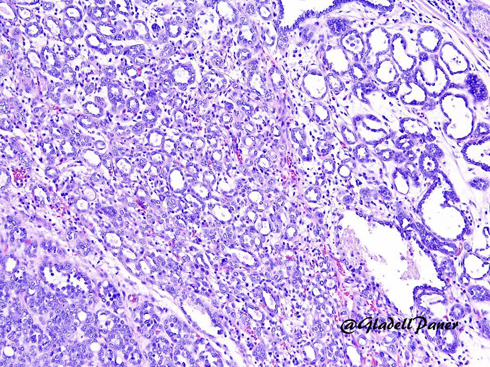 Gladell Paner, MD tweet media