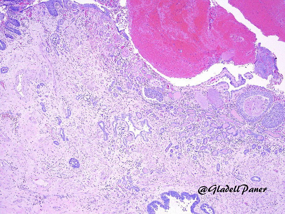 Gladell Paner, MD tweet media