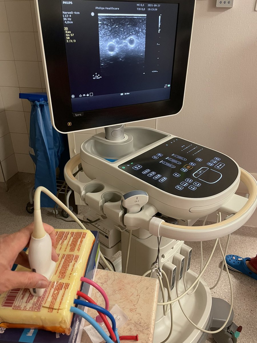 malyanesteta's tweet photo. Szybki sposób na vege trenażer do kaniulacji naczyń pod usg #usgiv #pocus:
-paczka pollenty lub tofu,
-słomka do wytworzenia kanału,
-chopsticks do wepchanie balonika do słomki
-długie baloniki z wodą (może być zabarwiona).
Przewlekamy baloniki i cyk, zabawka gotowa. 💉🤪 https://t.co/xoWcWIWt2N