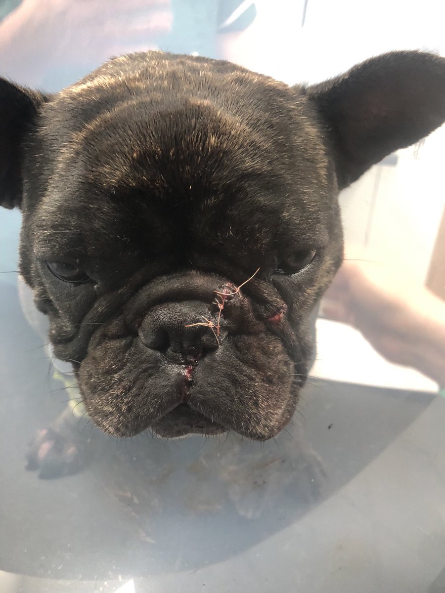 God love her 14 days in an umbrella thingy 😩❤️