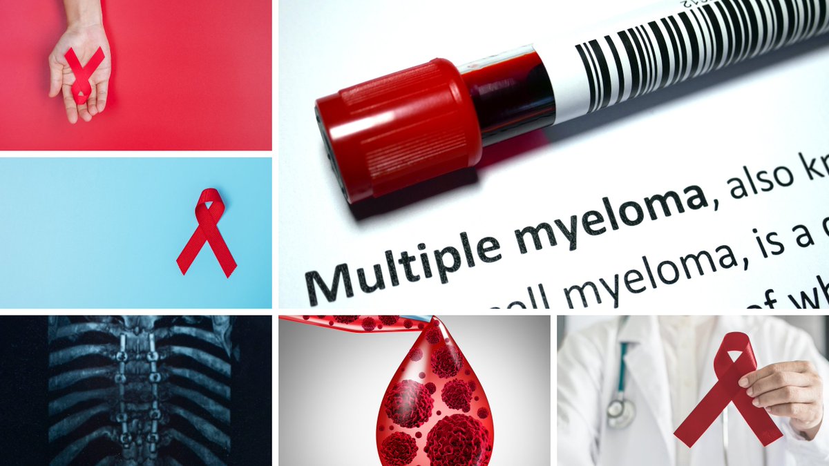 Secondmedic's tweet photo. I just published Understanding what Multiple myeloma is? — cause, prevention, symptoms, diagnosis &amp; treatment. https://t.co/fplj14ayS9 https://t.co/YKUlpN8wZC