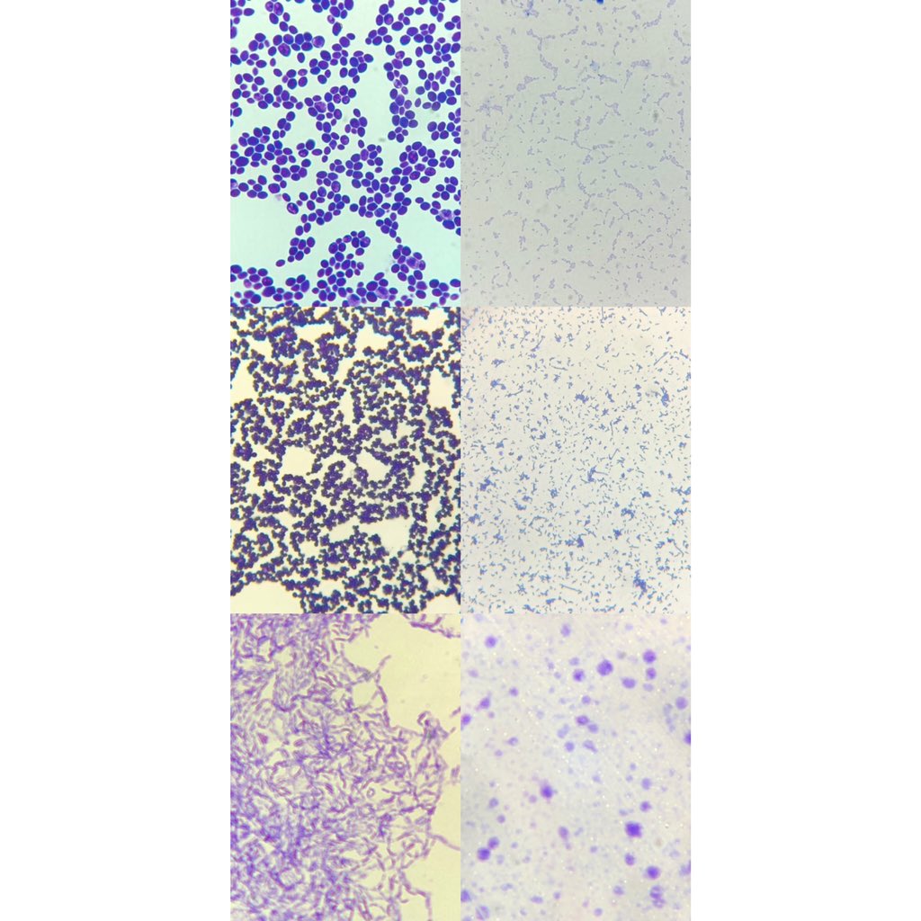javiermaranon_'s tweet photo. Primer día de prácticas de #microbiología, usamos cristal violeta para observar la forma del mcorg. @cienciasunav @microBIOblog https://t.co/BW97ceLgXc