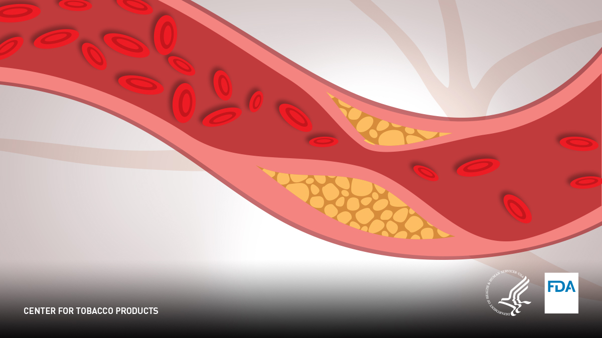 Does Smoking Constrict Blood Vessels? | Vital Health Facts Australia