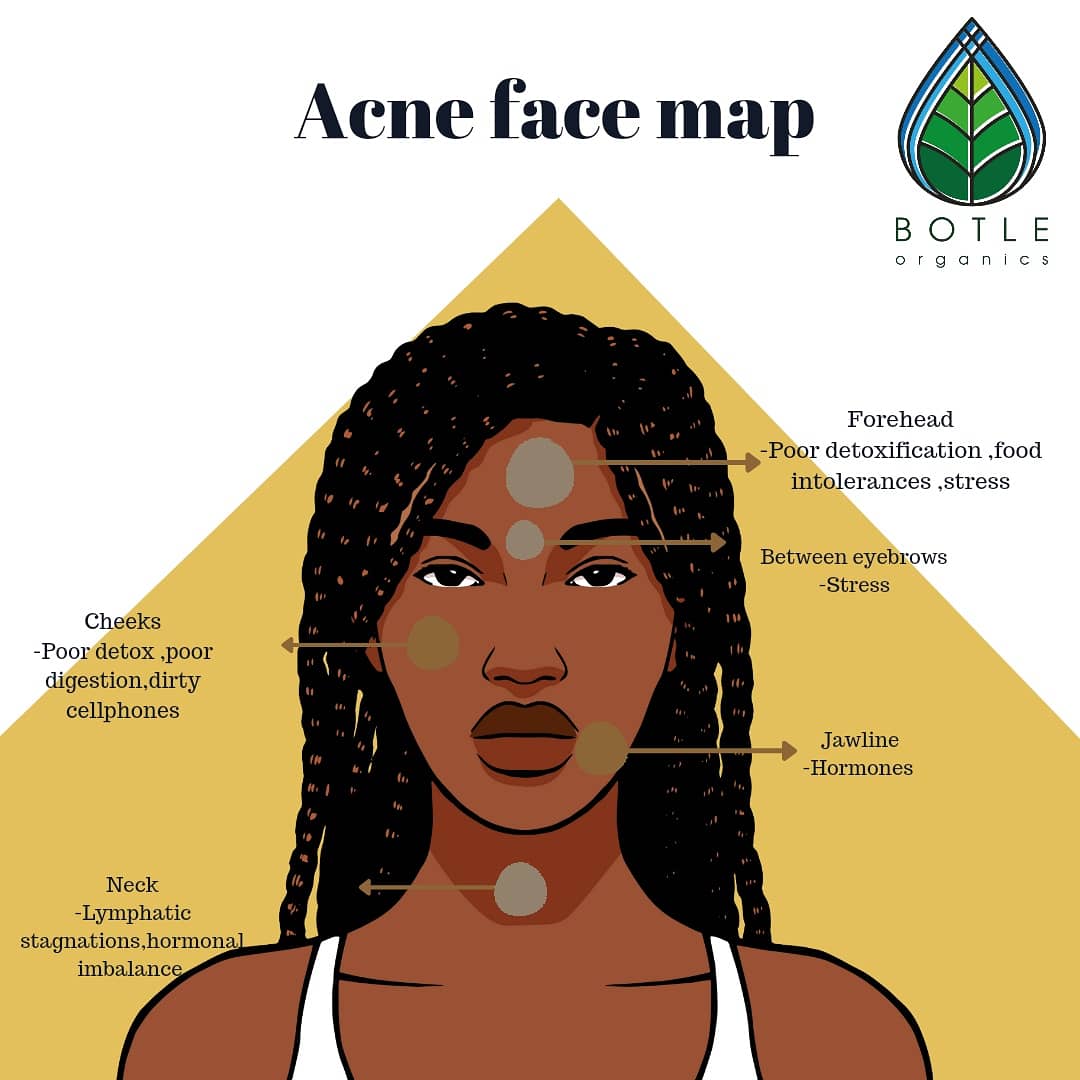 BotleOrganics's tweet photo. he Acne Clearing range consists of 3 products.

☆ACNE CLEARING FACE WASH.
-Removes dirt from the skin ,contains cucumber extract that calms and soothes the acne.
☆ACNE CLEARING TONER https://t.co/xiq9yqm7Mh