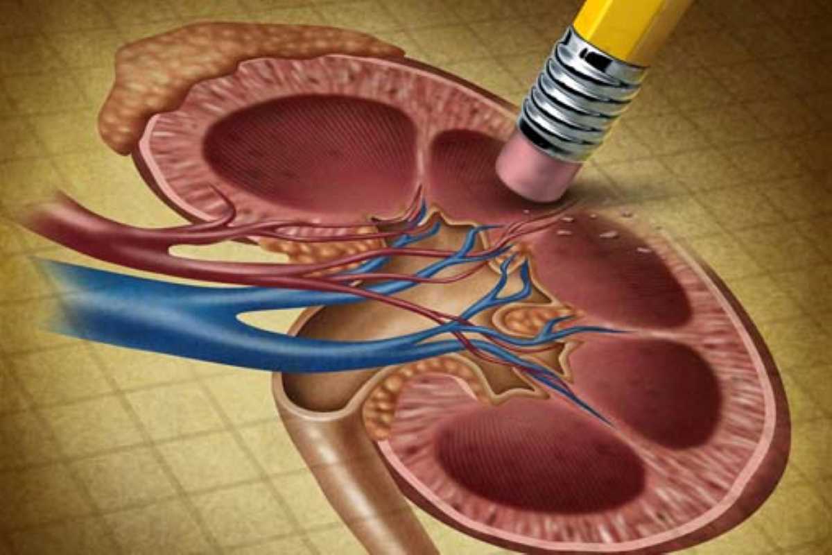 e_staffolani's tweet photo. Denervazione renale per il trattamento dell'ipertensione arteriosa. Una tecnica innovativa - non farmacologica e minimamente invasiva - apre nuovi orizzonti terapeutici nei casi difficili. 
https://t.co/L3d1f7SSc3 https://t.co/oE9hGUkfNI